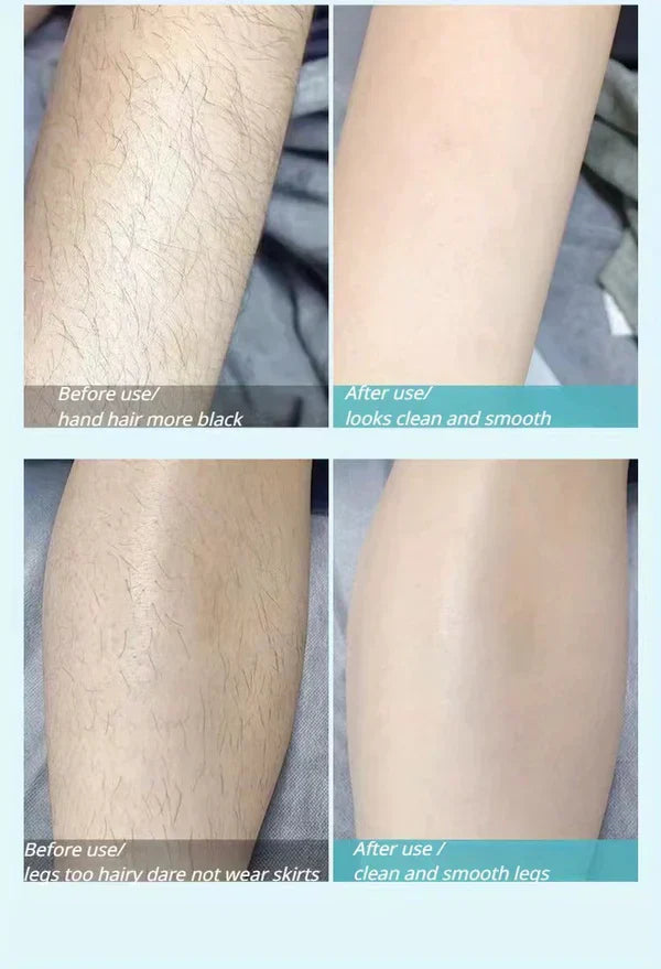 Imported™ Macro Blade For Sensitive Skin Razors 😍